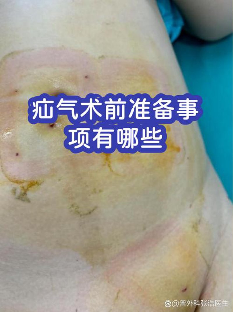 外科手术提升患者康复速度